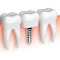 Top Dental Implant Services logo